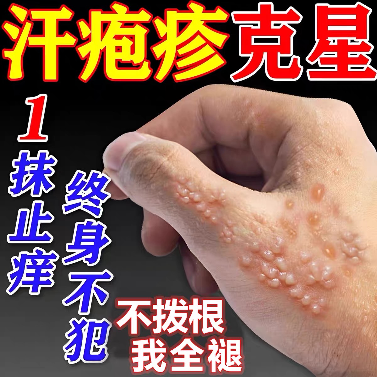 汗状疱疹专用软膏嘴唇疱疹脚疱疹手上起小水泡汗状疱疹