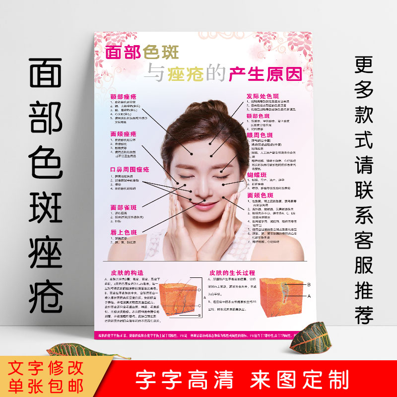 美容院面部色斑与痤疮痘痘产生的原因宣传海报广告图片墙壁画挂画