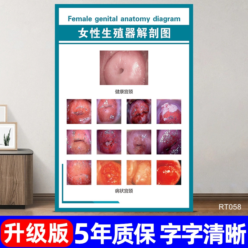 女性生殖器官解剖图医院人体内脏分布图宣传海报心脏示意图墙贴画