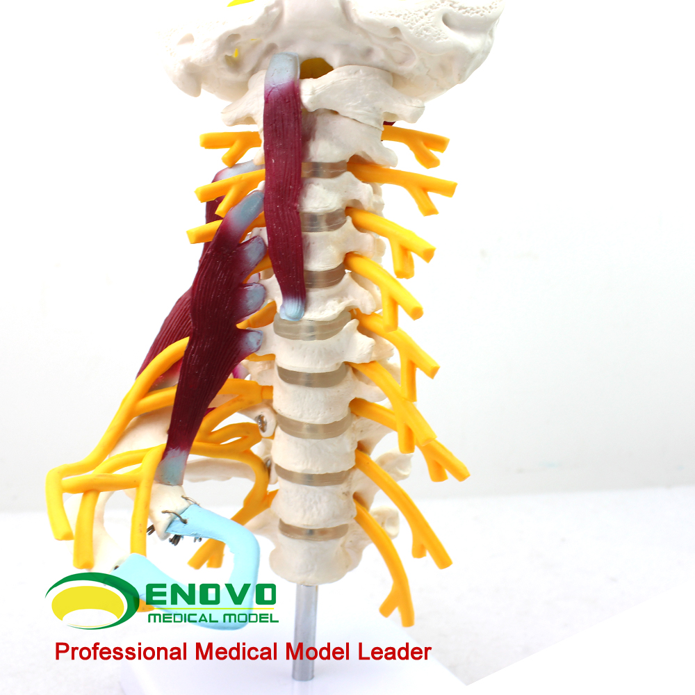 ENOVO颐诺医学人体颈椎模型颈臂丛神经肌肉模型 人体骨骼标本模型