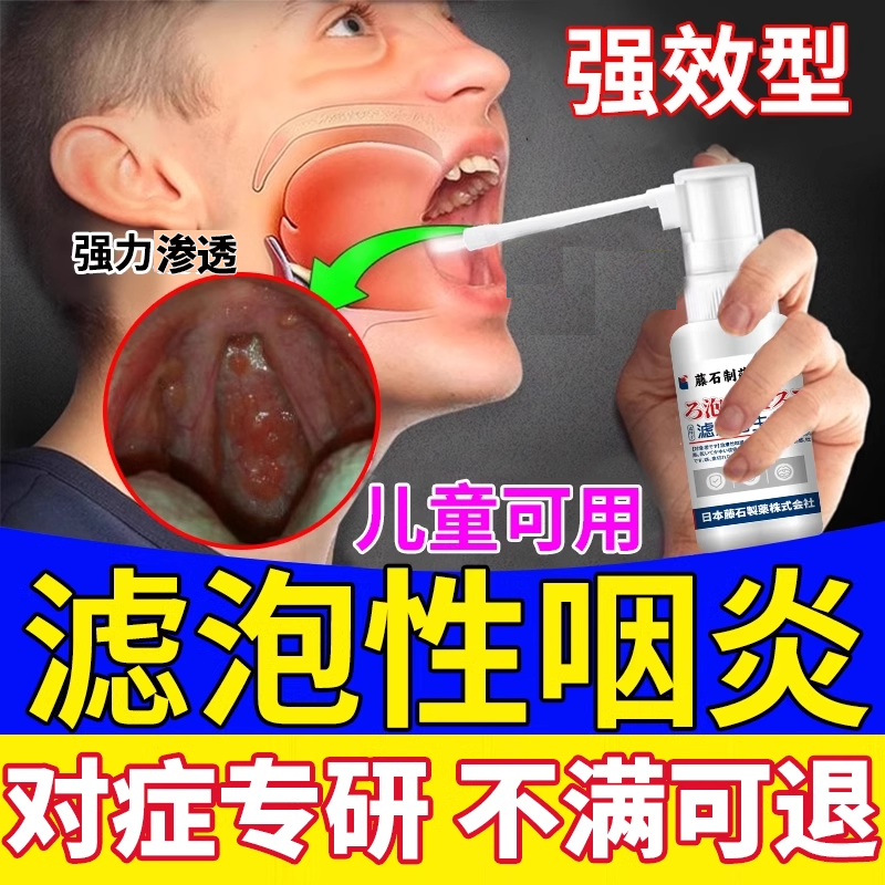 滤泡性咽炎慢性除根喷剂咽喉炎专用喷雾剂嗓子老有痰喉咙异物感OZ