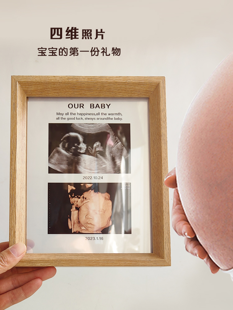 孕期报告单四维彩超b超照片打印做成纪念品孕妇NT记录怀孕照片透