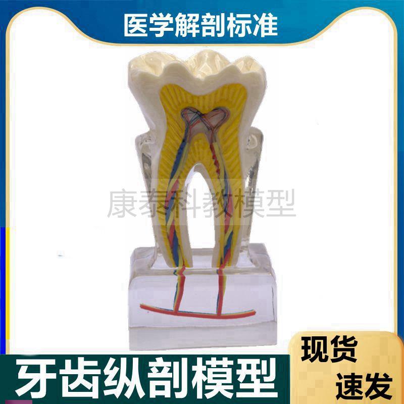 牙齿模型根牙髓腔神经血管口腔牙科医I用龋齿发展过程蛀牙病理医