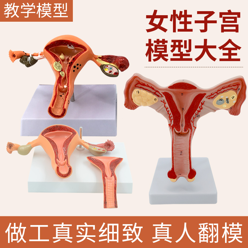 子宫模型 女性内生殖结构妇科模型 子宫解剖卵巢疾病 生殖科教具