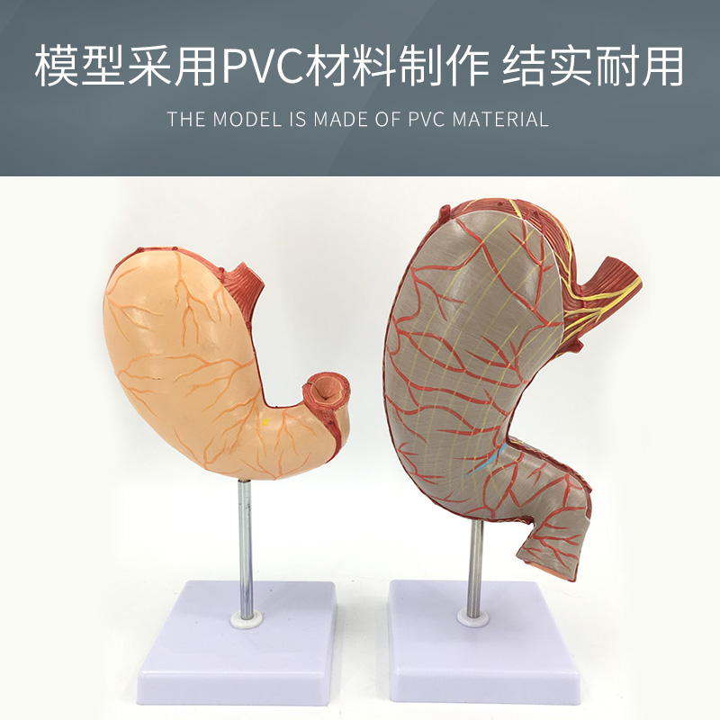 直销人体胃解剖模型 胃的病变模型 胃部疾病演示模型 病理胃 胃的