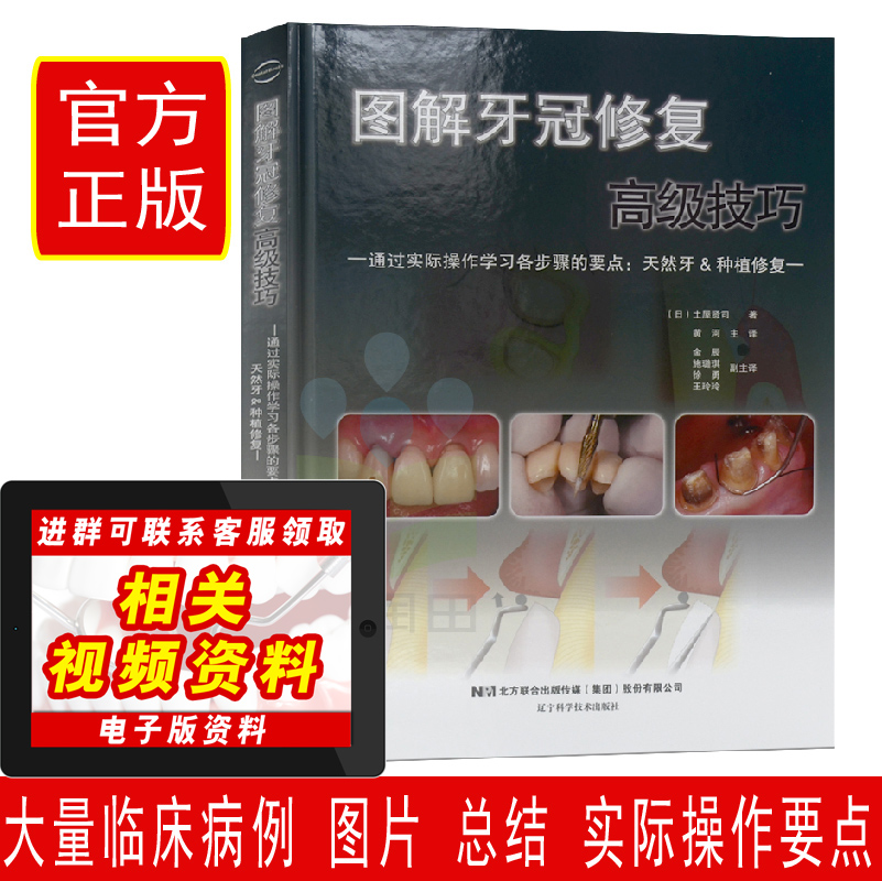 正版 图解牙冠gji修复技巧--通过实际操作学习各步骤的要点:天然牙或种植牙(日)土屋贤司著 口腔种植口腔科学 口腔医学类专业书籍