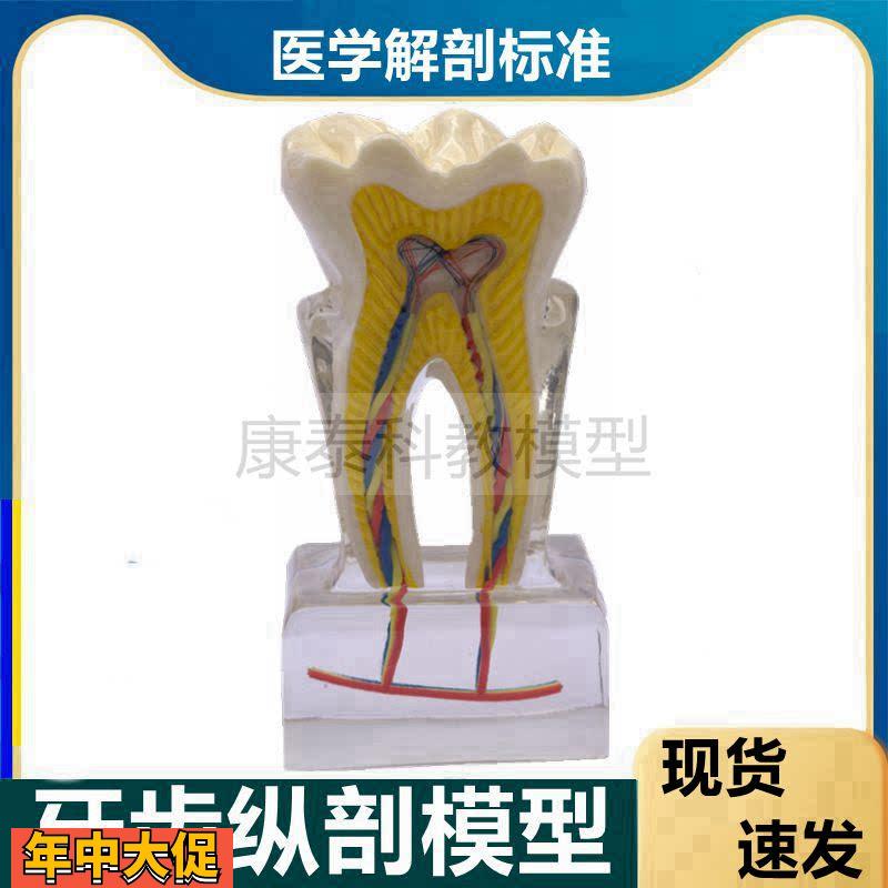 牙齿模型根牙髓腔神经血管口腔牙科医用龋齿发展过程蛀牙病理医患