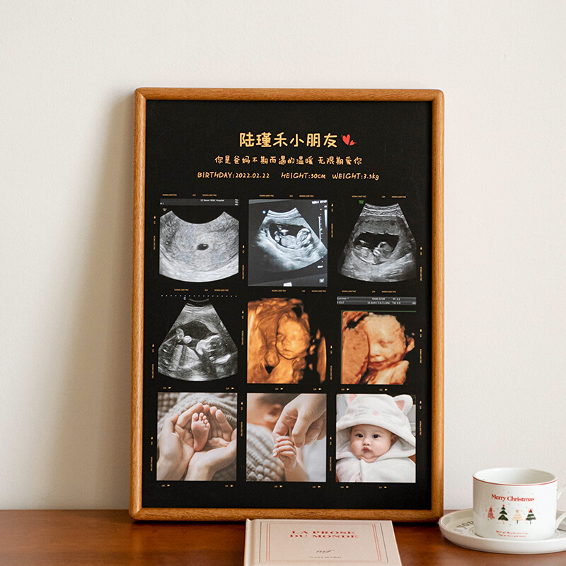 创意宫格相框冲洗四维照片宝宝B超婴儿周岁打印怀孕出生纪念礼物