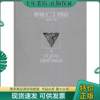 正版包邮肝癌CT图谱 9787542833532 程红岩主编 上海科技教育出版社