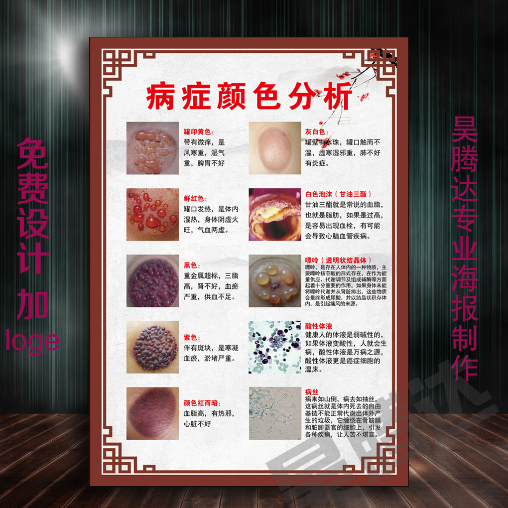 中医养生美容院广告宣传海报经络装饰画壁画拔罐印的对应症状挂图