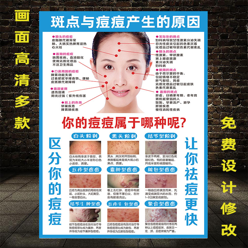 专业祛斑祛痘广告海报宣传画青春痘产生的原因痘痘类型痤疮广告图