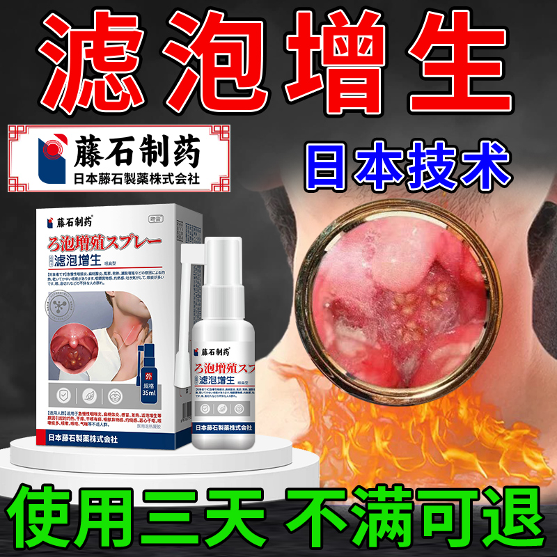 日本滤泡增生咽炎神器咽喉炎喷雾剂慢性咽炎除根咽炎治疗神器OL