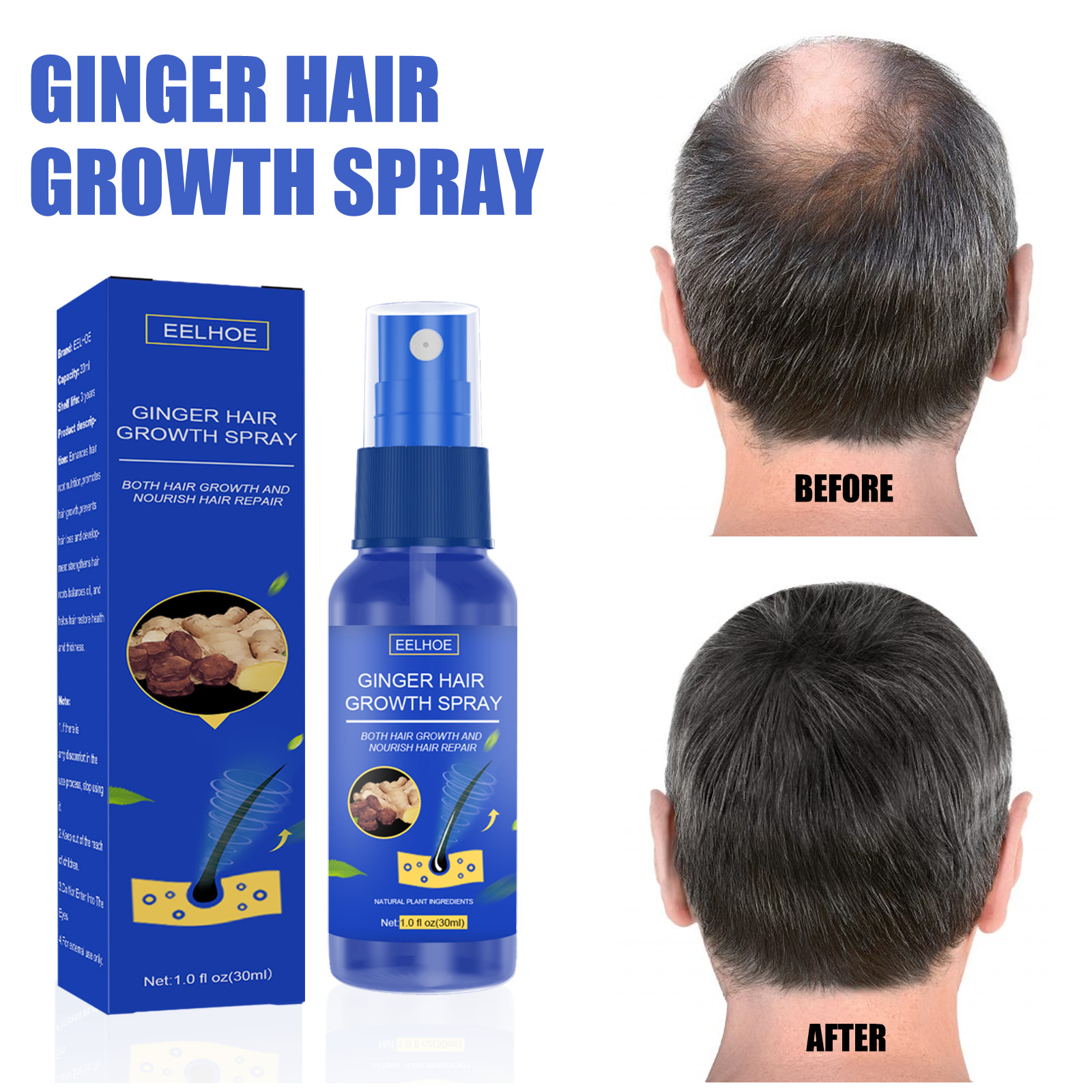 EELHOEGinger Hair Growth Serum Spray Anti Hair Loss Regrowth