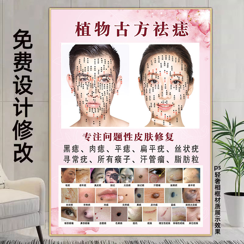 男女面痣图点痣海报脸部取痣宣传画植物古方祛痣图祛斑祛疣广告图