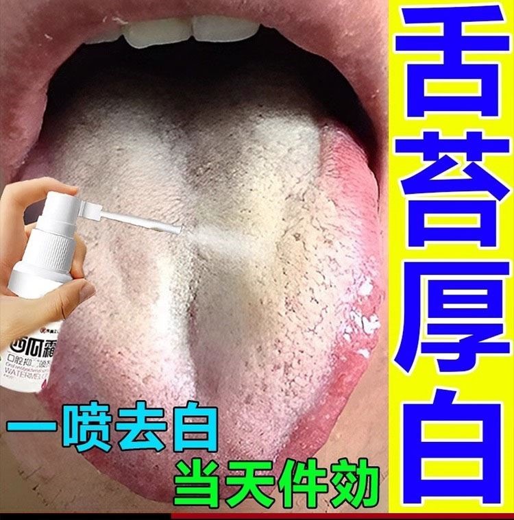 中医舌苔图片