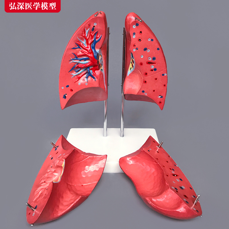 肺模型人体肺解剖肺部放大支气管呼吸系统结构造教学医学教具玩具