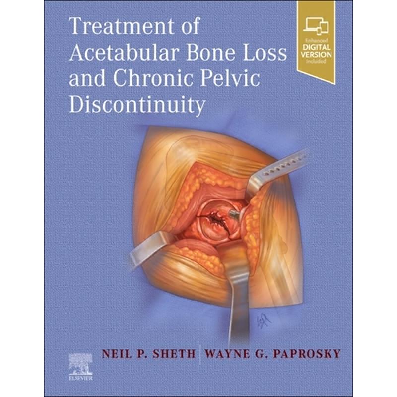 【4周达】Treatment of Acetabular Bone Loss and Chronic Pelvic Discontinuity [9780323875509]