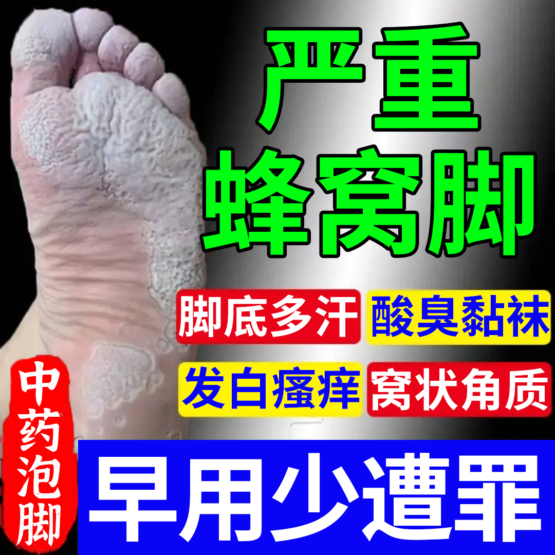 窝状角质松解症脚气臭脚泡脚药包止痒脱皮去真菌杀菌脚底蜂窝状EF