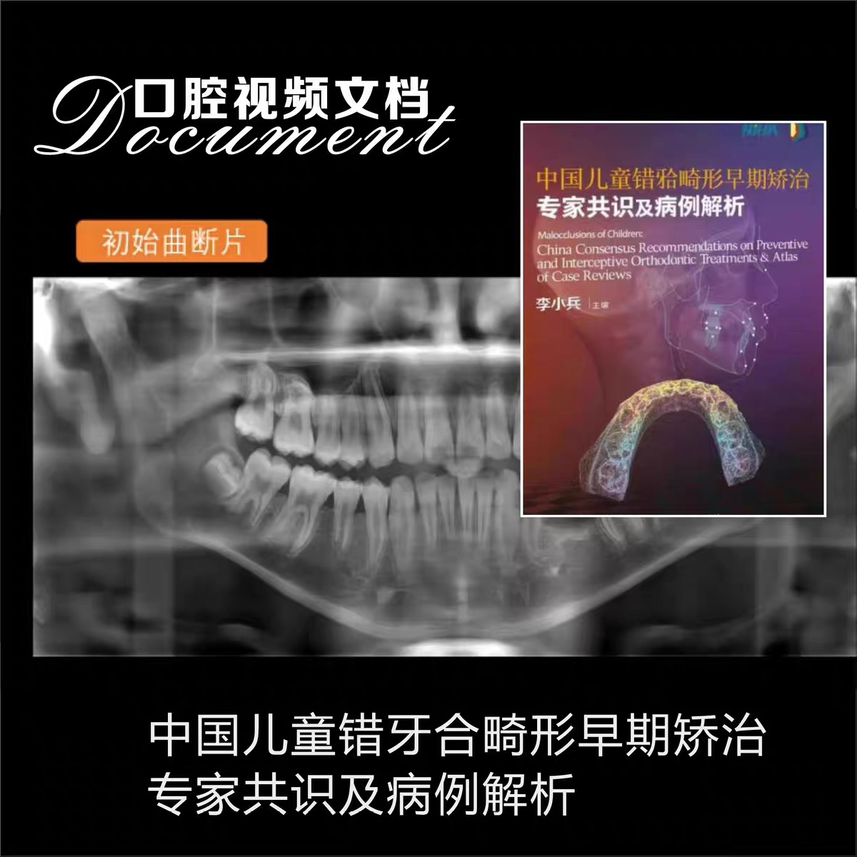 中国儿童错牙合畸形早期矫治  电子素材视频课程文档