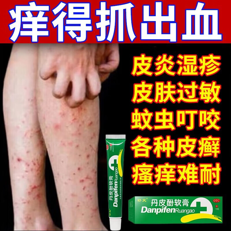 丹皮酚软膏止痒药膏皮肤瘙痒腿上长疙瘩湿疹皮肤过敏止痒专用药