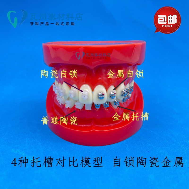 牙科4种托槽对比模型 正畸陶瓷金属自锁托槽托槽示范模型特价包邮