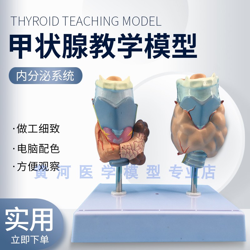 甲状腺病理模型 病态 喉头解剖模型 甲状腺病变模型 甲状腺模型