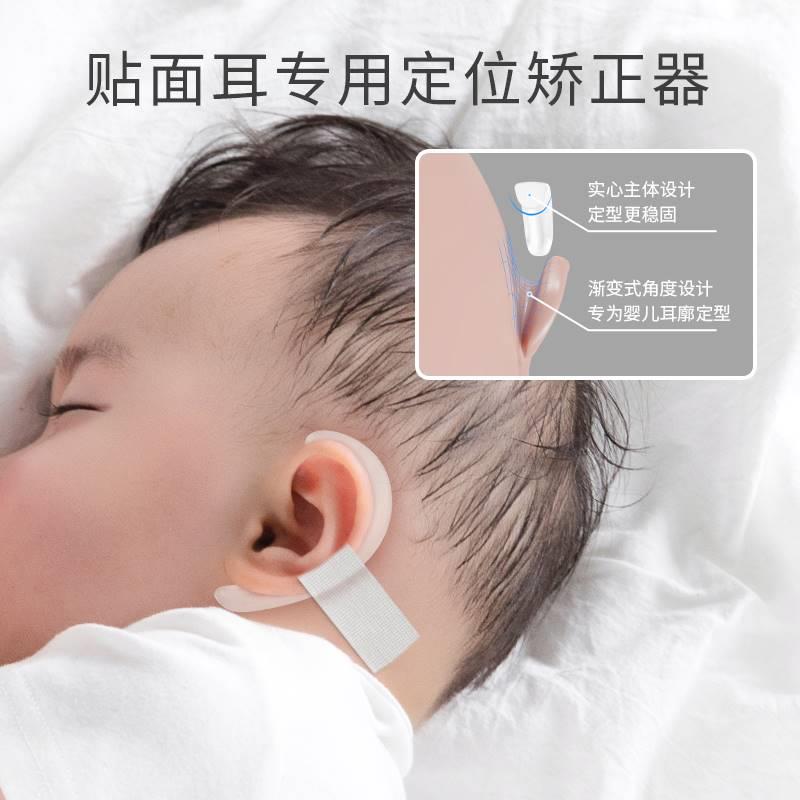 【贴面耳专用】耳朵矫正器婴儿宝宝耳贴纠正定型耳廓硅胶耳夹儿童