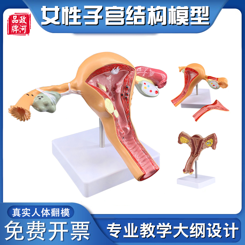 女性子宫解剖模型 正常病变卵巢子宫模型 人体模型医院用教学模型