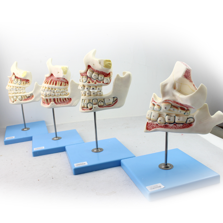 ENOVO颐诺儿童牙列与颌骨发育模型乳牙恒牙幼儿口腔牙齿模型牙齿