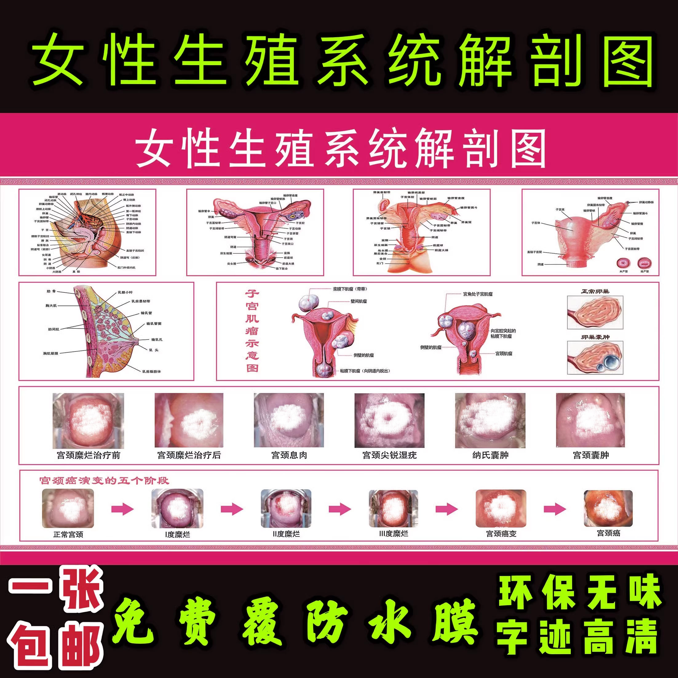 女性生殖器系统解剖图 医院宣传挂图子宫 妇科海报宫颈疾病示意图