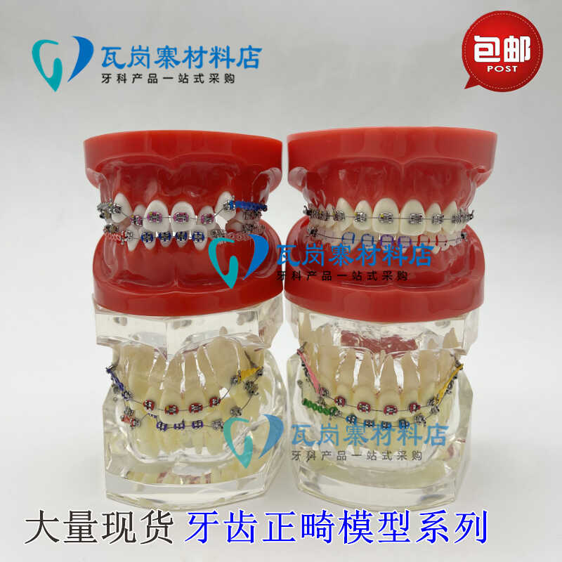 牙科正畸模型 透明错颌矫正展示模型 结扎丝托槽正畸带支抗钉牙列