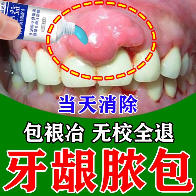 牙龈脓包牙根发炎牙龈肿包肿痛消炎药牙肉增生牙龈炎上火专用牙膏