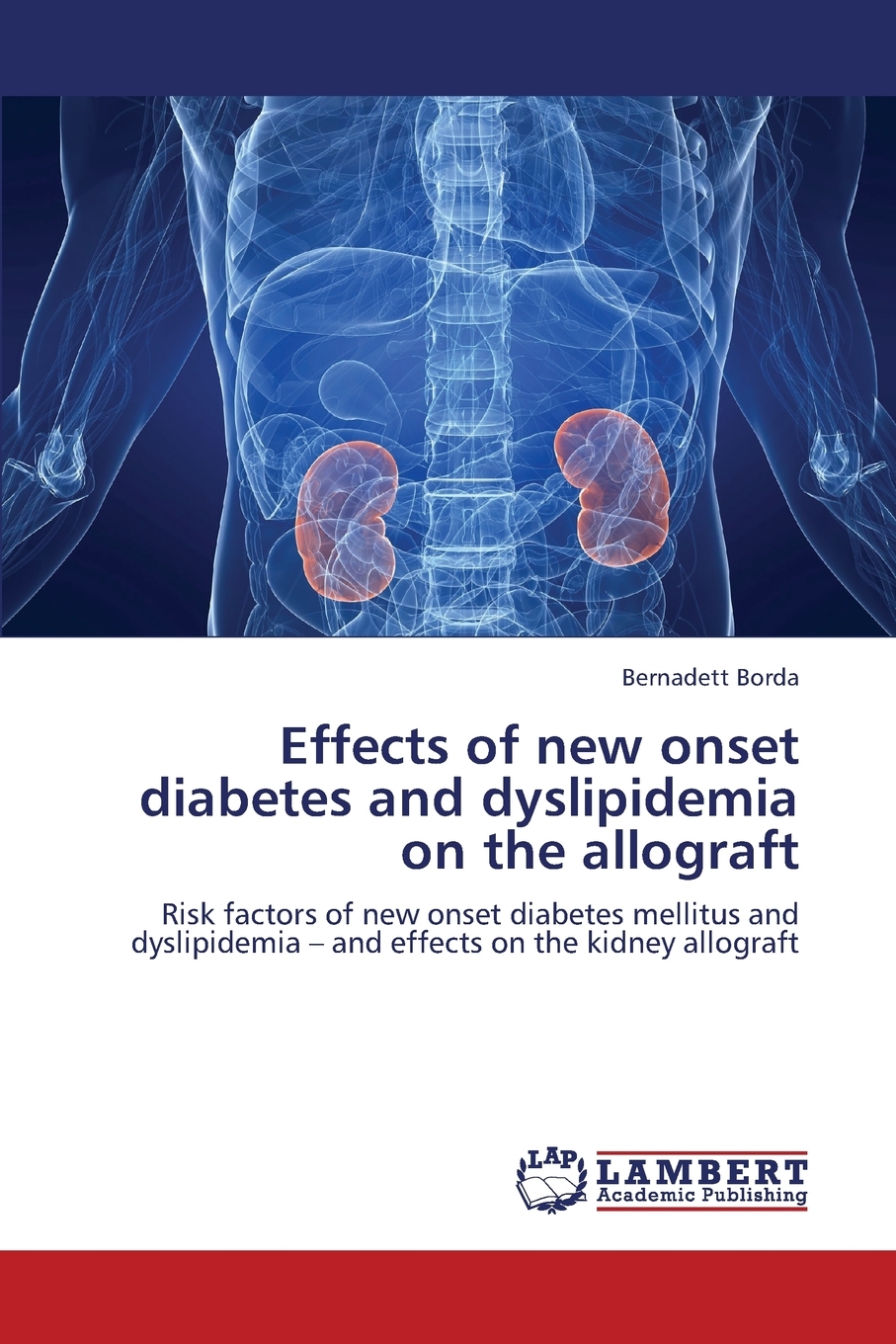 【预售按需印刷】Effects of New Onset Diabetes and Dyslipidemia on the Allograft