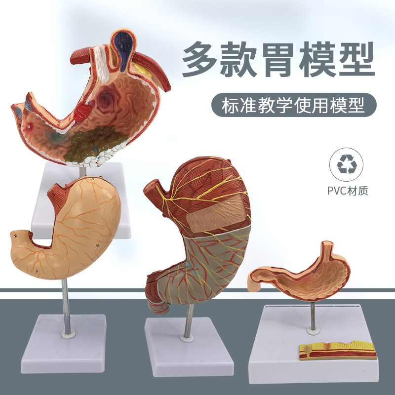 人体胃解剖模型 胃的病变模型 胃部疾病演示模型 病理胃 胃的穿孔