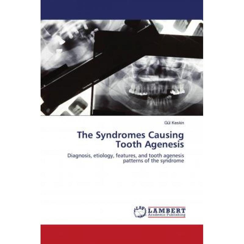 【4周达】The Syndromes Causing Tooth Agenesis [9786202679688]