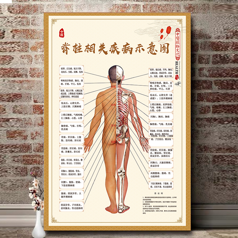 脊柱相关疾病示意图挂图脊椎人体经络背部穴位图人体脊椎骨骼结构