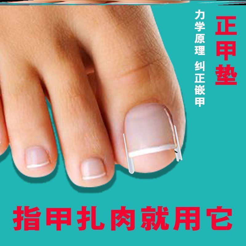 脚指甲填充垫片治疗甲沟炎矫正神器贴片指甲隔离垫专用消炎嵌甲片