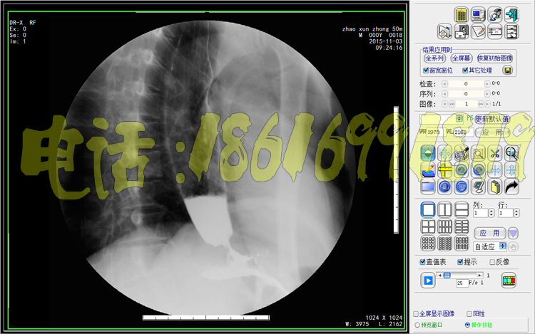DR软件CR工作站软件CT工作站软件数字胃肠X光机软件MRI工作站软件