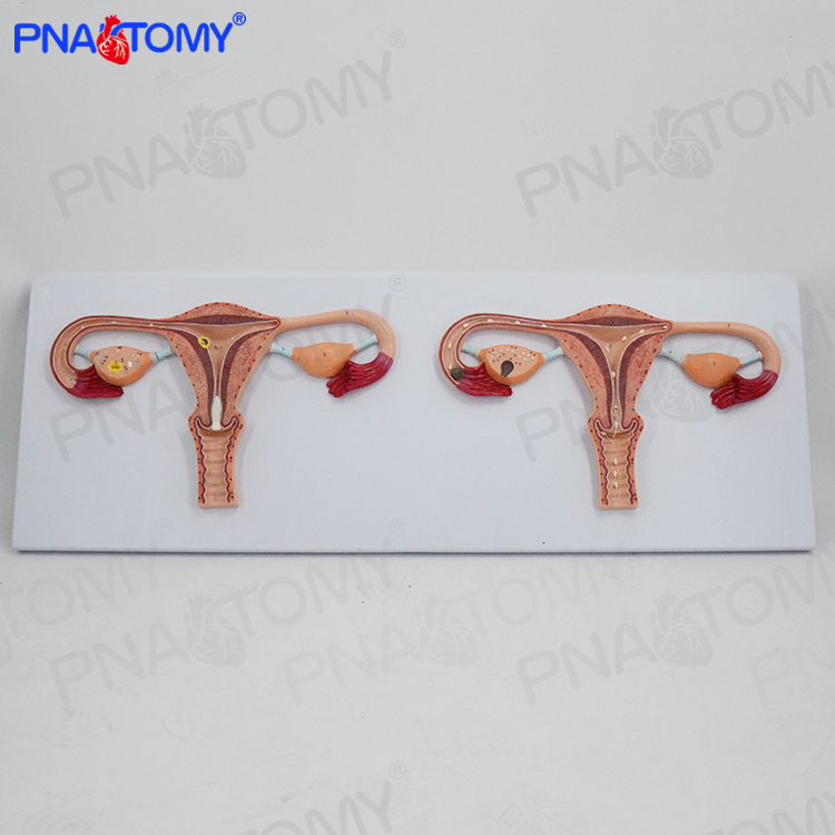 医用卵子受精过程放大解剖模型子宫卵巢受精卵生殖科计生展示模型