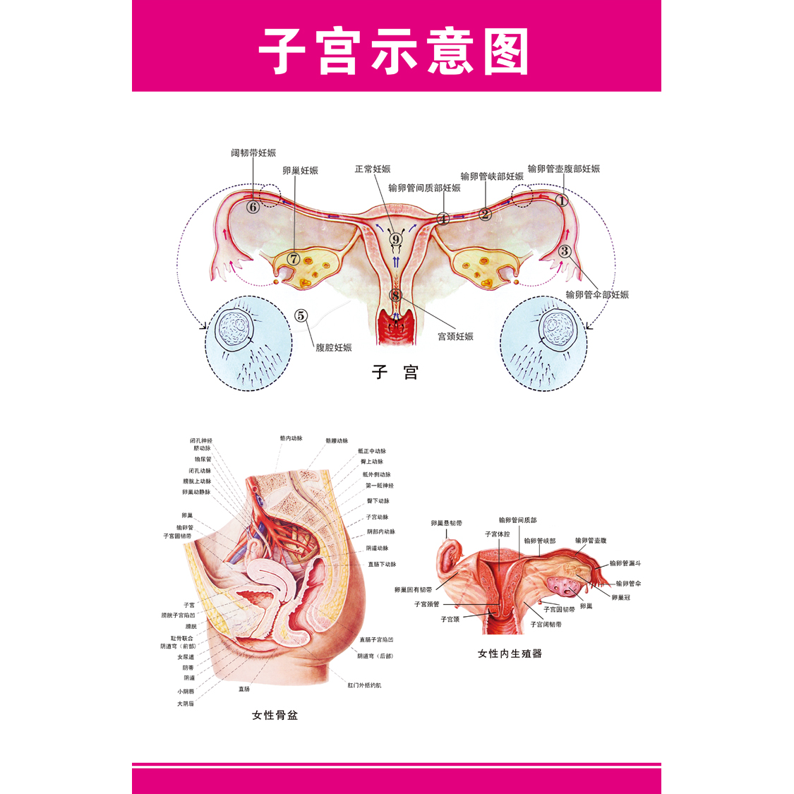 女性生殖器解剖图 医院宣传海报挂图子宫 妇科海报宫颈疾病示意图