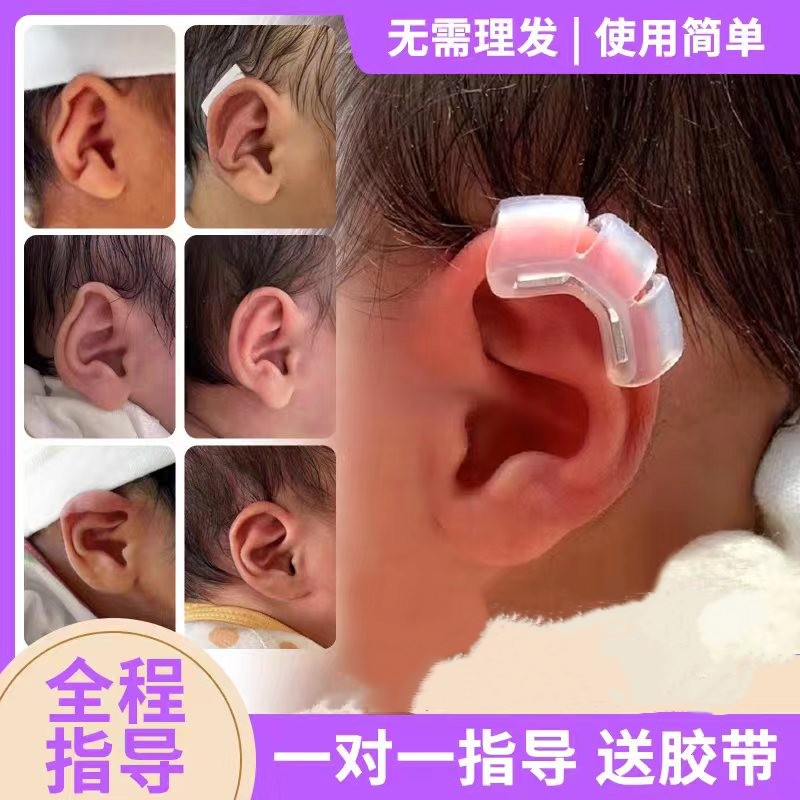 婴儿耳朵矫正器新生的儿耳廓矫形贴纠正塑形定型牵引器外耳垂宝宝