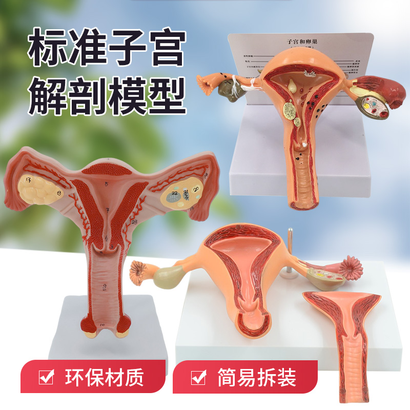 子宫卵巢病理病变 生殖科病理妇科子宫解剖模型 女性子宫病理模型