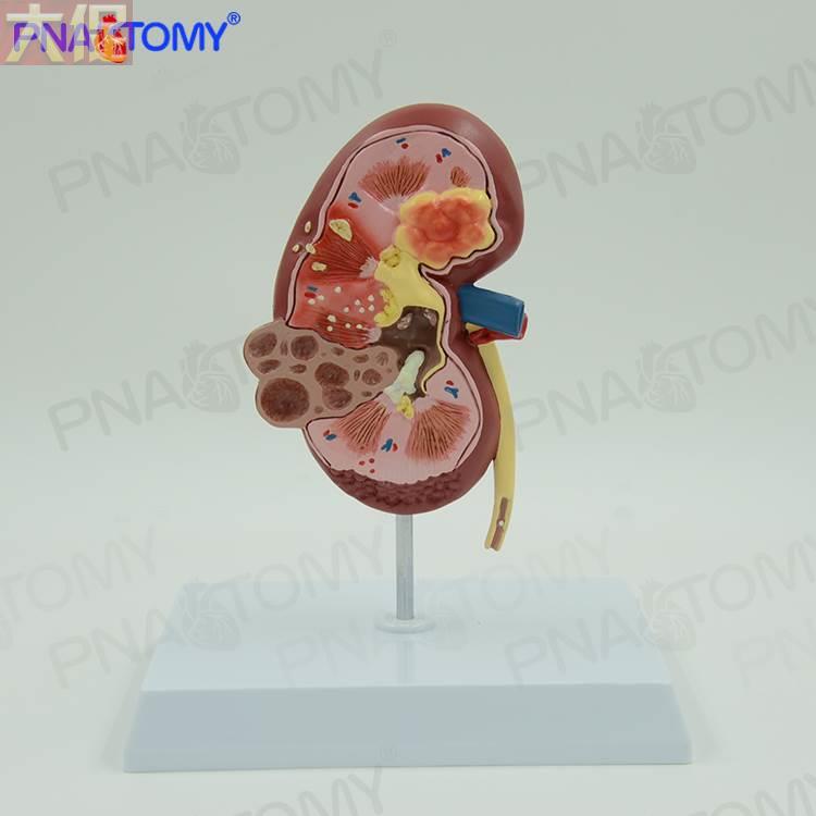 肾脏的解剖结构图片