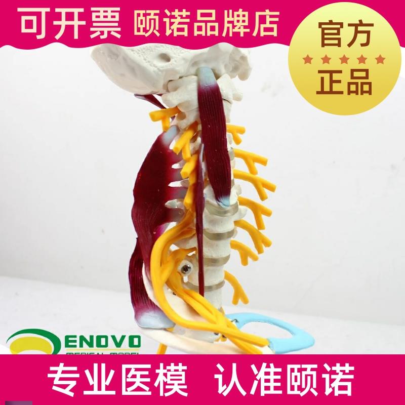ENOVO颐诺医学人体颈椎模型臂丛神经肌肉O模型人体骨骼标本模型