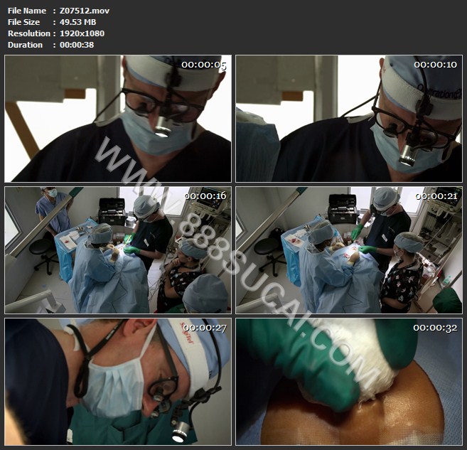 国外专家兔唇患者小孩做整形手术医疗高清实拍视频素材
