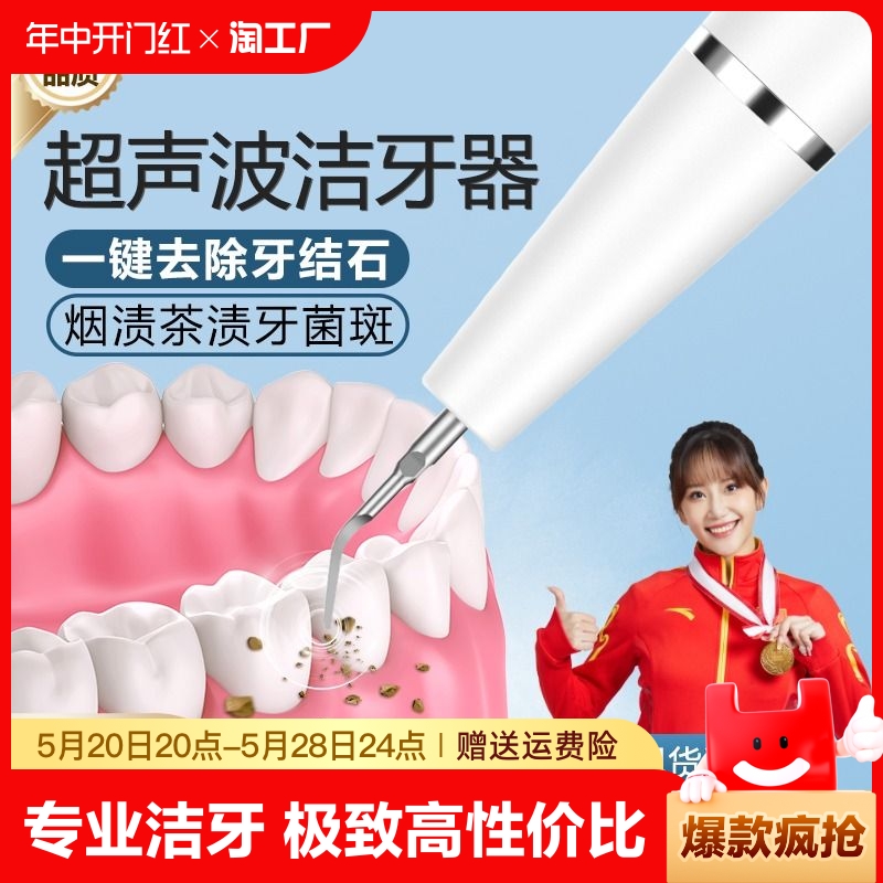 超声波洗牙器家用洁牙仪冲牙结石去除神器牙齿污垢清洁牙石牙垢机