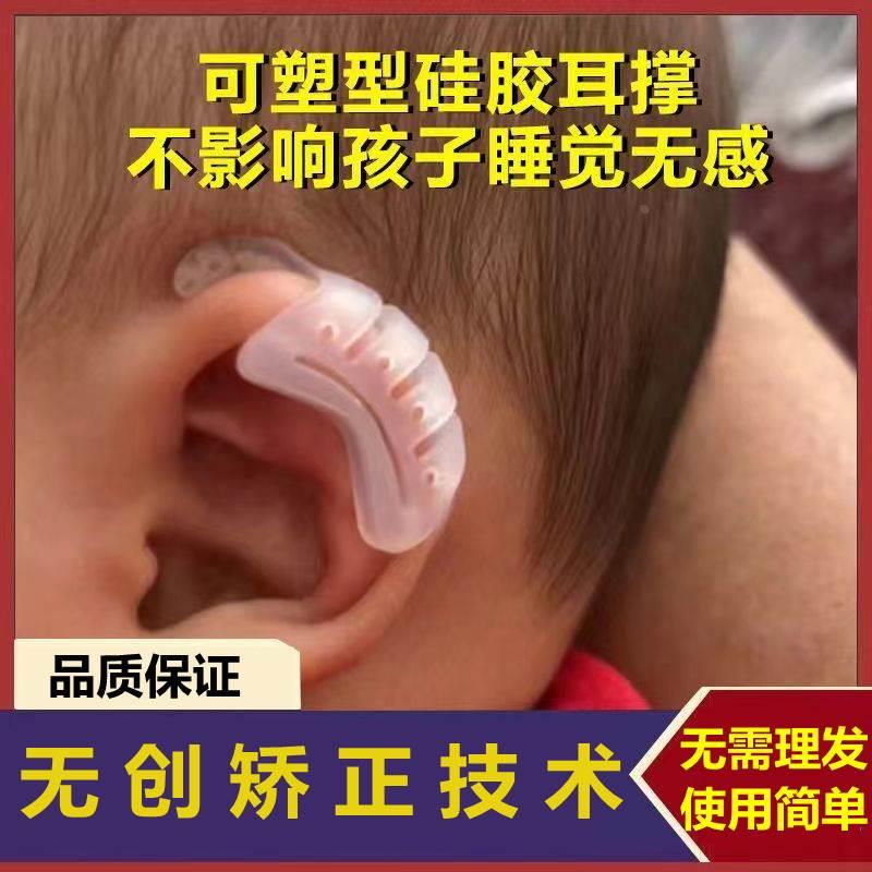 婴儿耳朵定型贴耳廓矫正器招风耳塑形新生儿畸形耳垂隐耳纠正耳撑