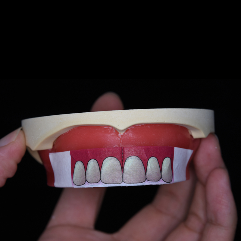 全口门牙定位贴纸吸附性义齿排牙个别托盘蜡堤牙科工具口腔技师