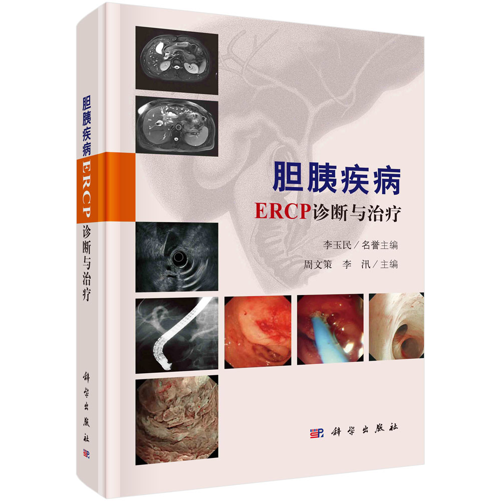 胆胰疾病ERCP诊断与治疗 李玉民 胆道及胰腺的解剖生理ERCP诊疗技术胆道疾病的ERCP诊疗胰腺疾病的ERCP诊疗等书籍KX
