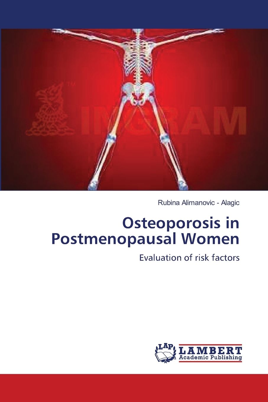 预售 按需印刷Osteoporosis  in Postmenopausal Women